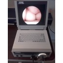 Przenośny zestaw endoskopowy STORZ Tele Pack 200430 20