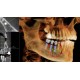 Tomograf stomatologiczny I-CAT 3D